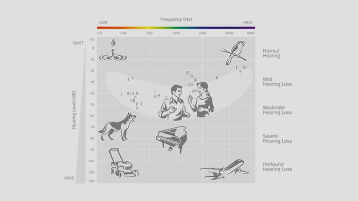 The Audiogram The Audiogram