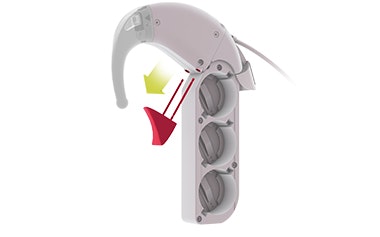 OPUS2_removeConnectingPiece OPUS2_removeConnectingPiece