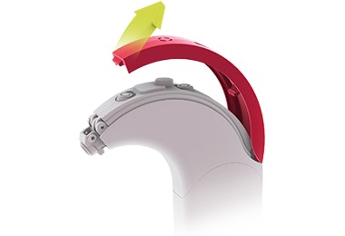 Sonnet-Cover-Remove Sonnet-Cover-Remove