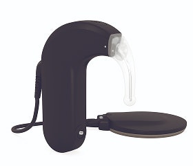 SONNET 3 behind-the-ear cochlear implant audio processor.