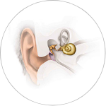 Conductive and Mixed Hearing Losses Conductive and Mixed Hearing Losses