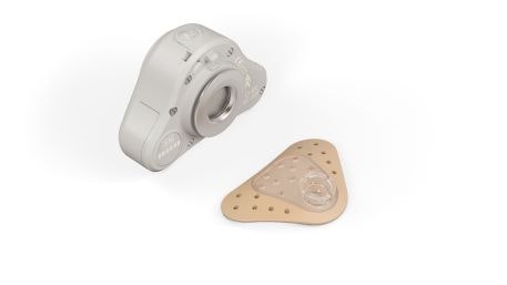 ADHEAR MED-EL's Non Surgical Bone Conduction System