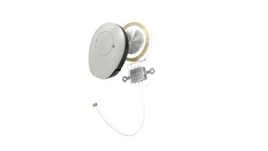 VIBRANT SOUNDBRIDGE Middle Ear System