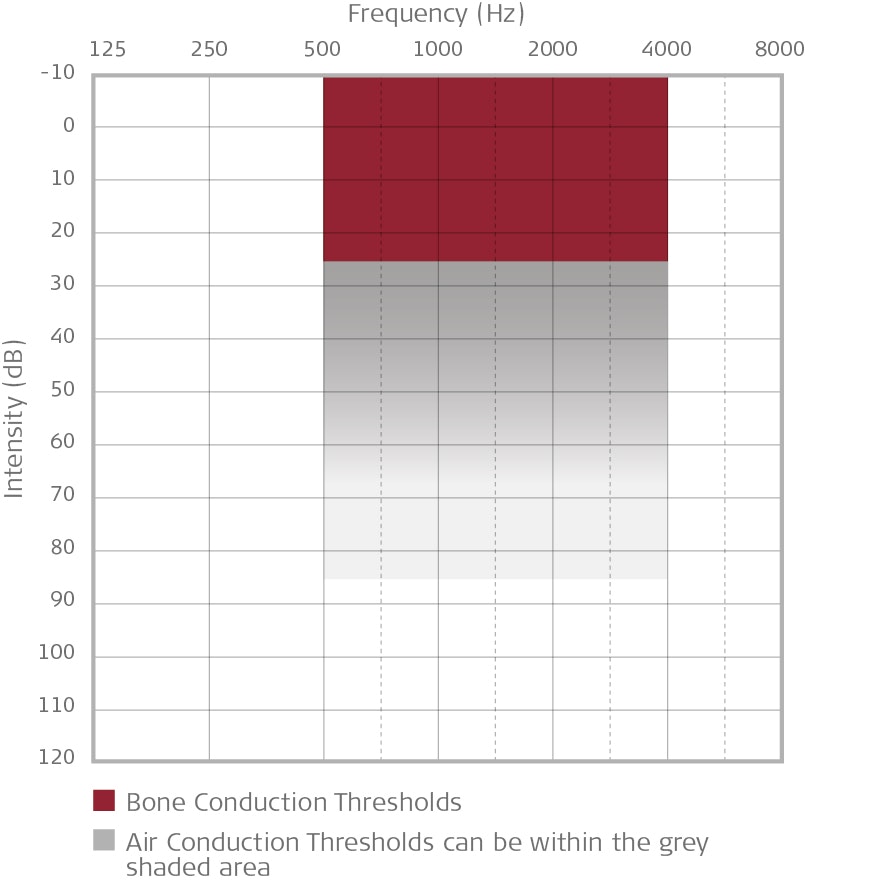 Audiogram Audiogram