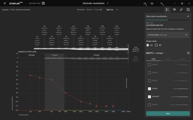 OTOPLAN Electrode Analysis