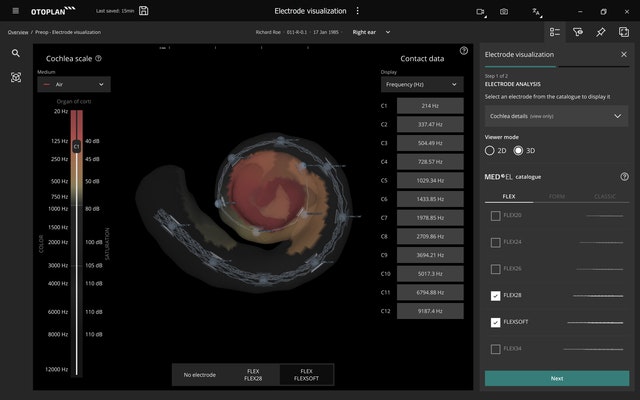 OTOPLAN Electrode Visualization