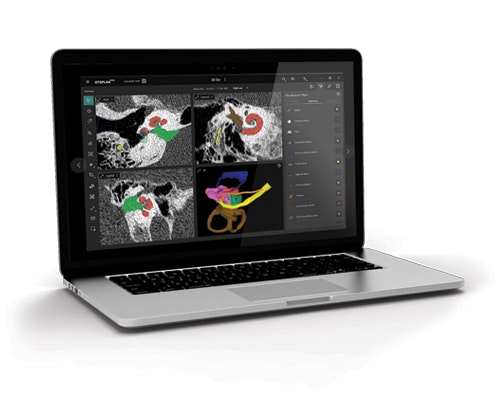 OTOPLAN Software for Cochlear Implant